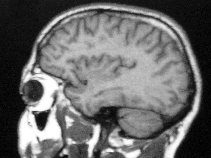 Beauty may be skin deep but
 ugly goes right on through.